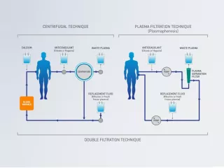 How TPE works